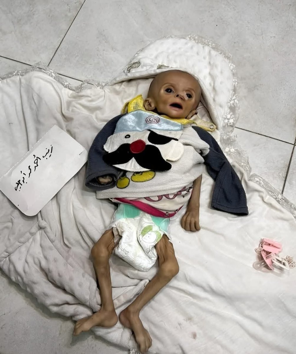 Hey Zionist Evils.

Palestinians never gassed you, if you are looking for vengeance then go back to Germany.

Leave Palestinian children alone.
The world won't forget your atrocities you are inflicting upon Palestinians.

Zionism is Evil
#Gaza #GazaGenocide #GazaStarving #Israel
