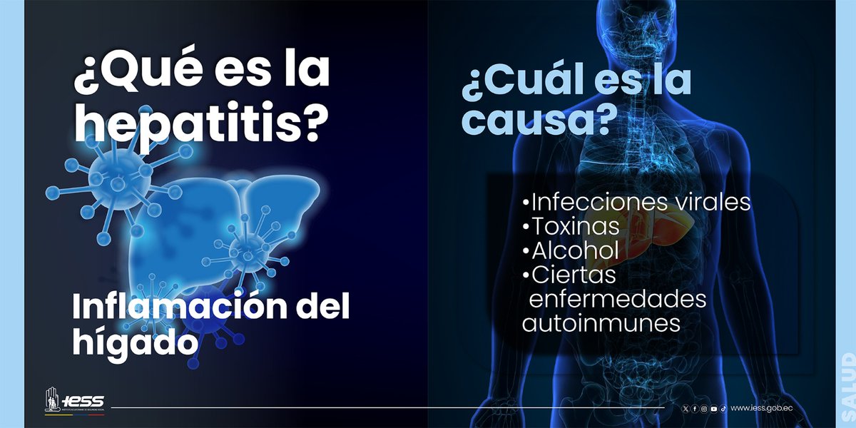 #IESSesPrevención | Conoce qué es la #hepatitis y cuáles son sus síntomas ↓