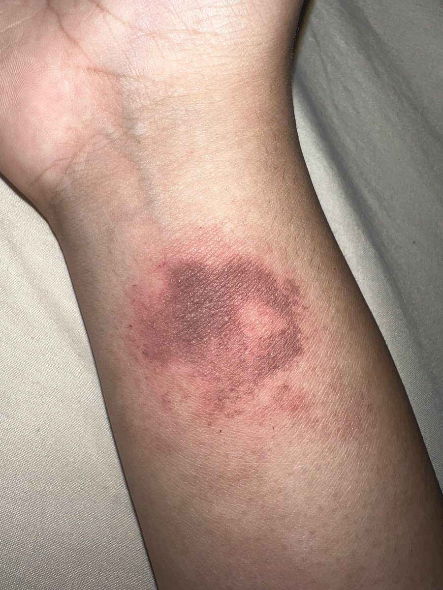 It was quite literally nothing and honestly embarrassing. It only happened in the first place because I thought a guy I had sex with with was coming over, but then he didn’t. And what’s the point of doing this if nobody will see it? So I left it at that #shtwt #burntwt