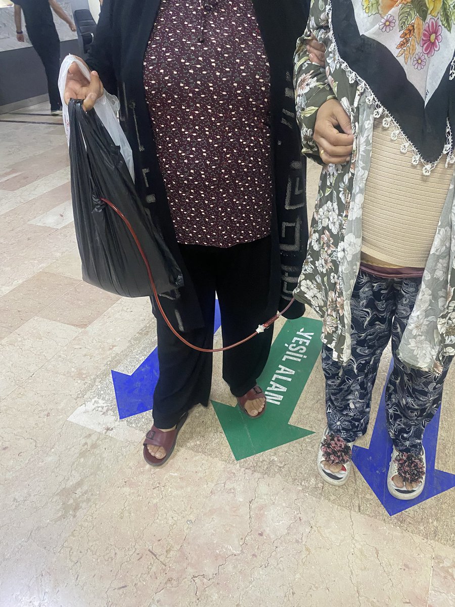 Gaziantep üniversite hastanesi <a href="/GaunHastanesi/">GAÜN Hastanesi</a> 20/ 07 /2025
Genel cerah doktoru, kız kardeşimin Karın bölgesinde kitle oluşumu ndan dolayı amaliyata aldı, o bölgeden bol miktarda su boşaltılmış olup, yine aynı bölgeden parca alınıp patolojiye gönderidi. 

24/ 07/2025 taburcu