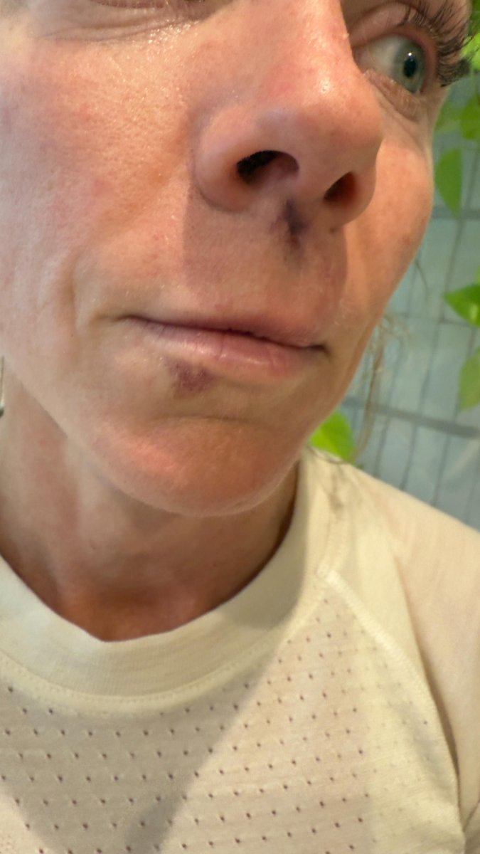 Dallas Hero tweet media