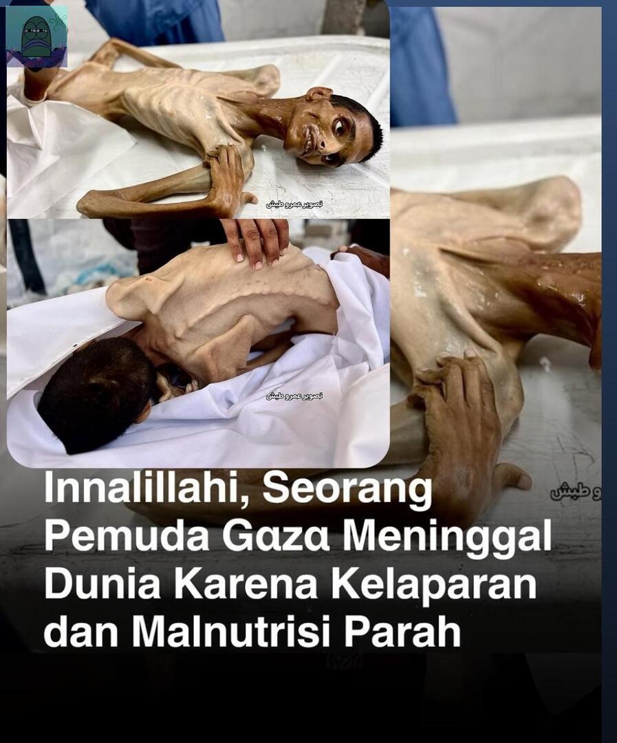 TW // Starvation 
innalillahi 💚 sender gak tega ngeliat nya 😭