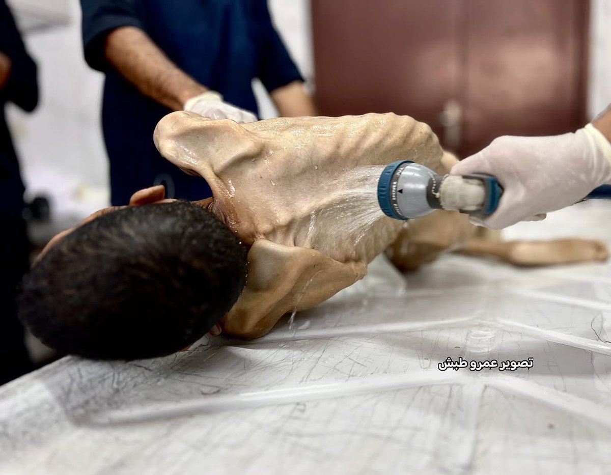 What if it was your child?