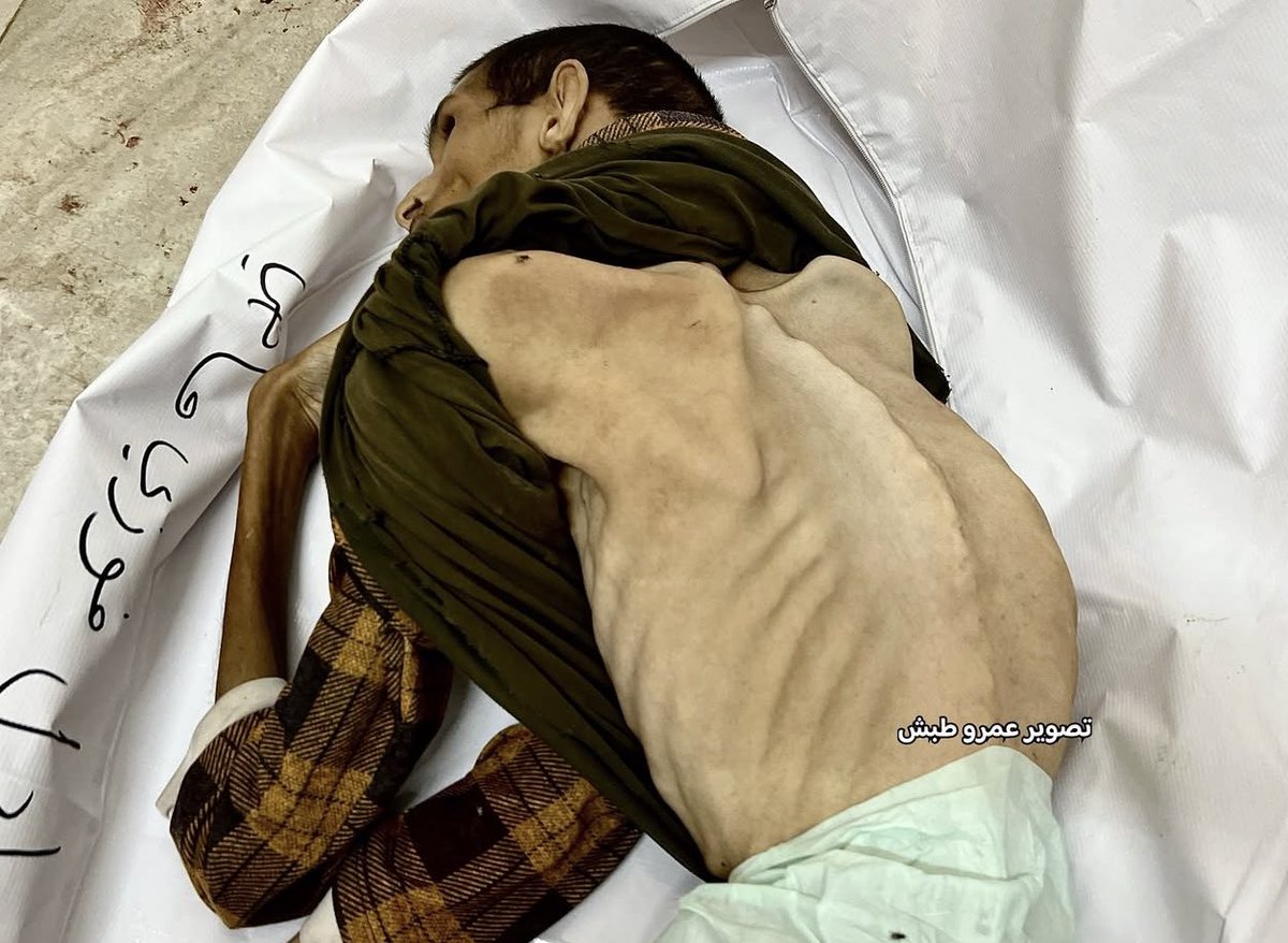 Starved to death 🇵🇸💔