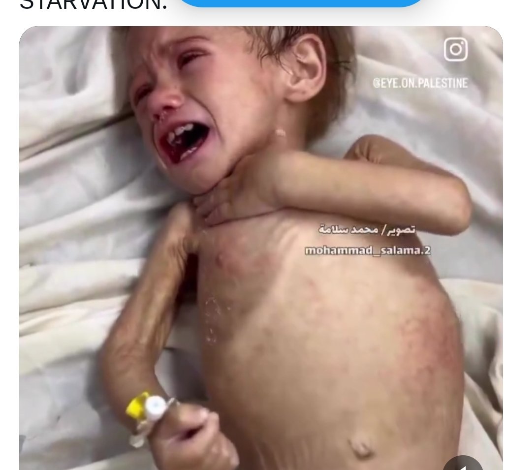 هناك مجاعه تحدث ونحن نشارك بالصمت