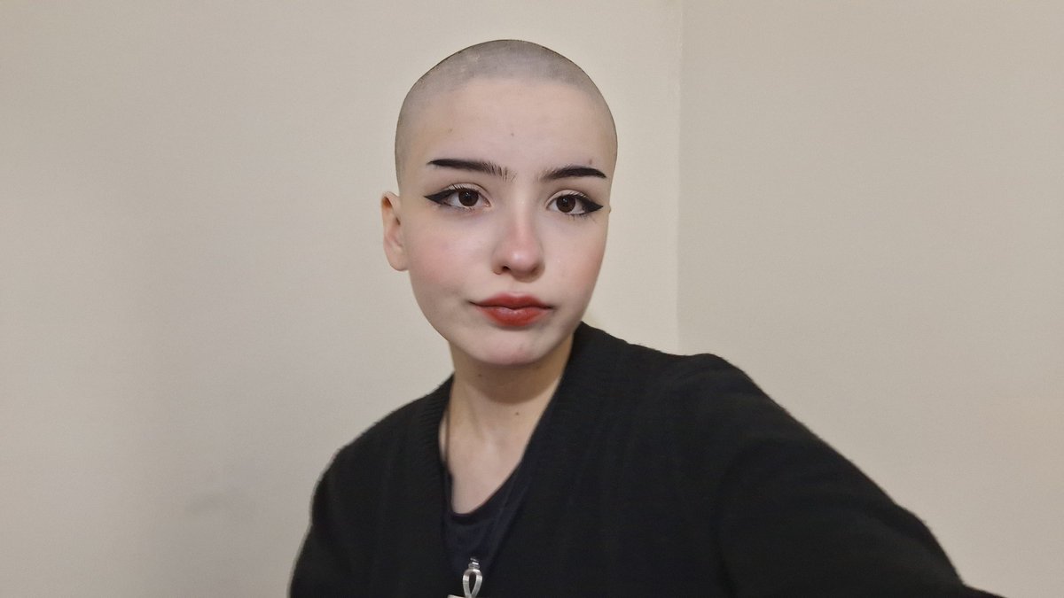 👩🏻‍🦲