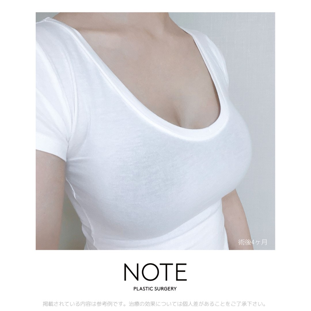 韓国ノート美容外科 tweet media