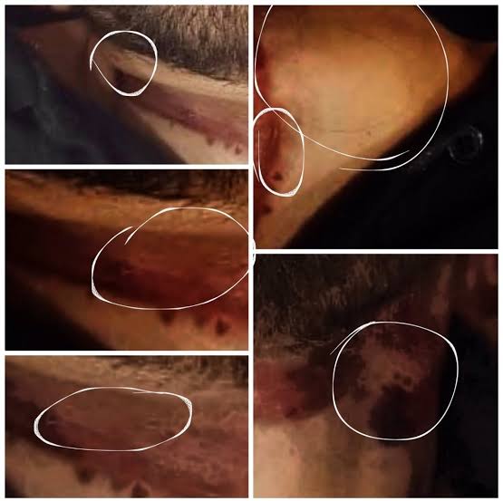📌Why were Stun Gun Marks On Sushant's Neck❓

@ips_nupurprasad
<a href="/IPS_Association/">IPS Association</a> <a href="/PMOIndia/">PMO India</a> <a href="/HMOIndia/">गृहमंत्री कार्यालय, HMO India</a> <a href="/CBIHeadquarters/">Central Bureau of Investigation (India)</a> 
Maha Anyaay With SSR
#JusticeForSushantSinghRajput