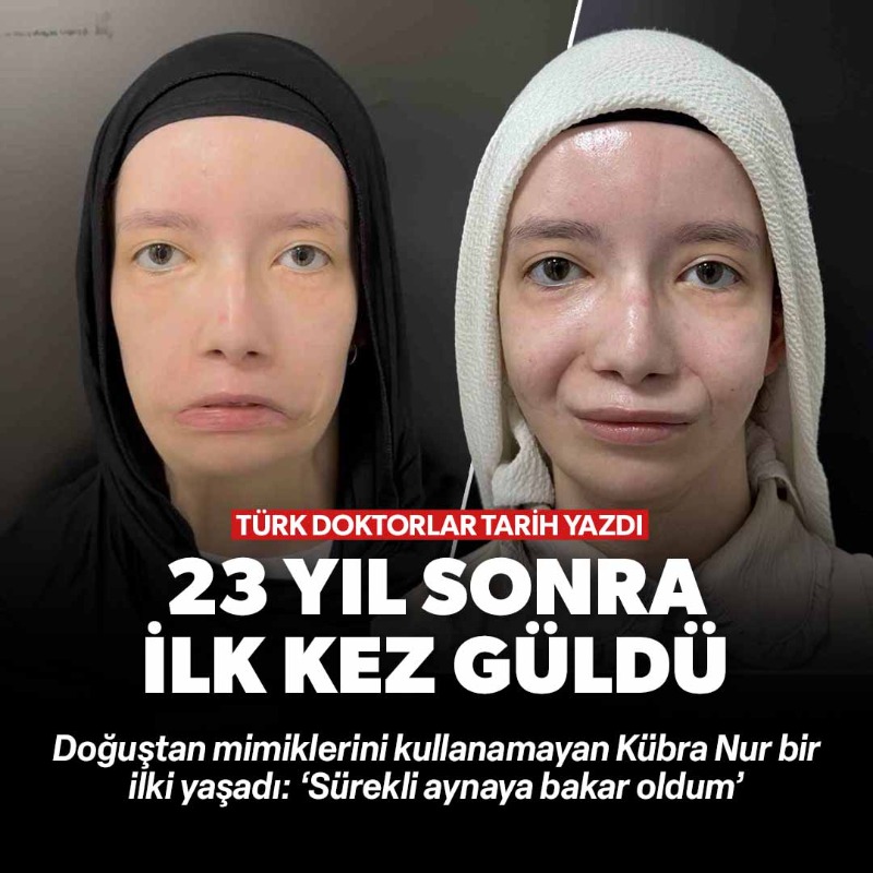 yenisafak's tweet photo. Doğuştan mimiklerini kullanamayan Kübra Nur Sevgi, 23 yıl sonra ilk kez gülümsedi.