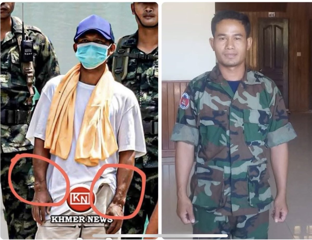 jerrrycheese's tweet photo. What did you do to my soldiers.
Where is your care based on international humanitarian principle like you told us ? 
#ExposeThailandLies 
#ReleaseCambodiaSoldiers 
#FreeCambodianSoldiers https://t.co/sKZK3sBJCJ