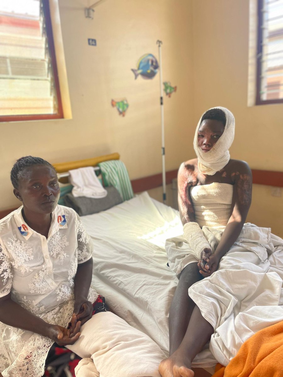 nassaropiyo's tweet photo. 16-year-old Lakica Sharon from Latoro, Nwoya is battling severe burns at Lacor Hospital, Gulu. She urgently needs surgery worth UGX 547,000 ($153) to avoid permanent neck damage.
Her widowed mother is helpless.

Please help this beautiful girl live a normal life.

📞 0786812442 https://t.co/gkXEM5TWLQ