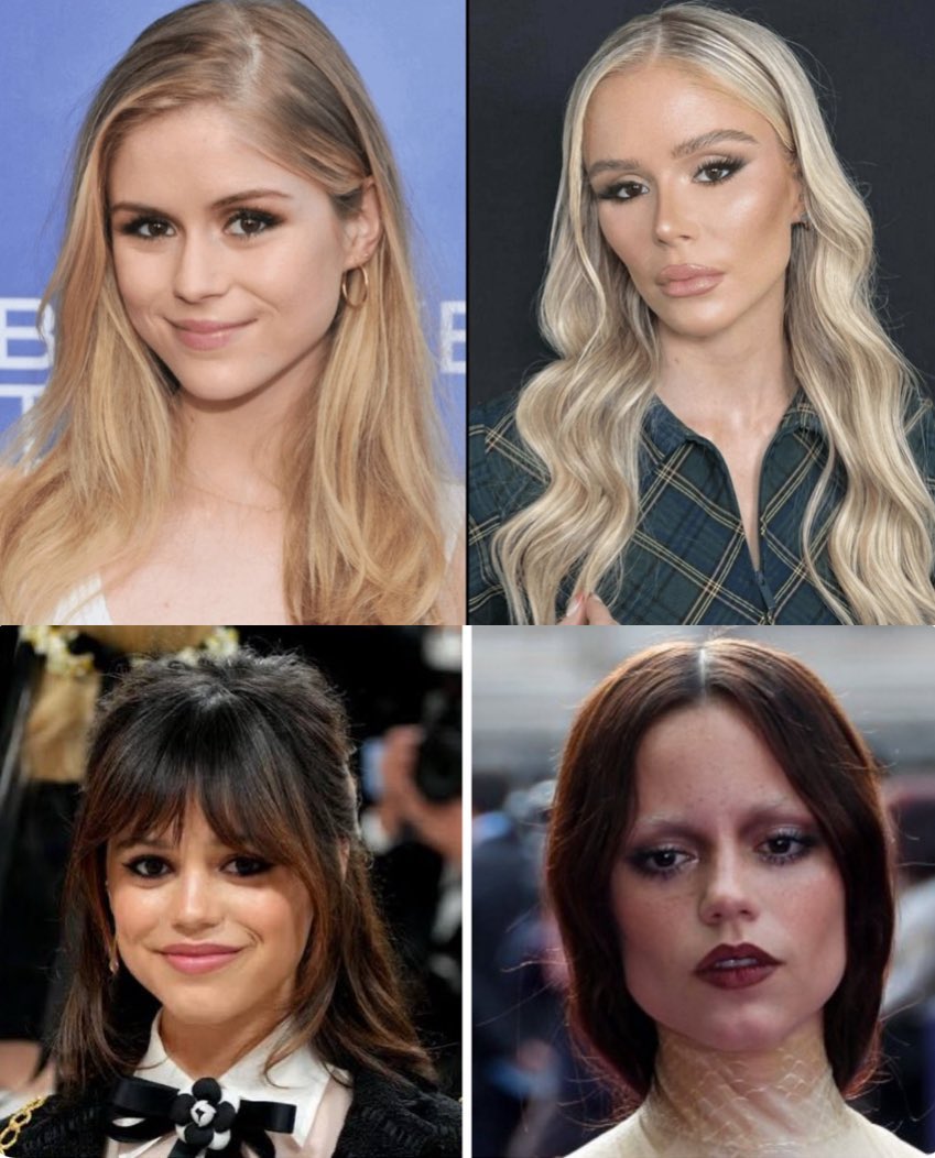 Show me one female who looked better after plastic surgery.....