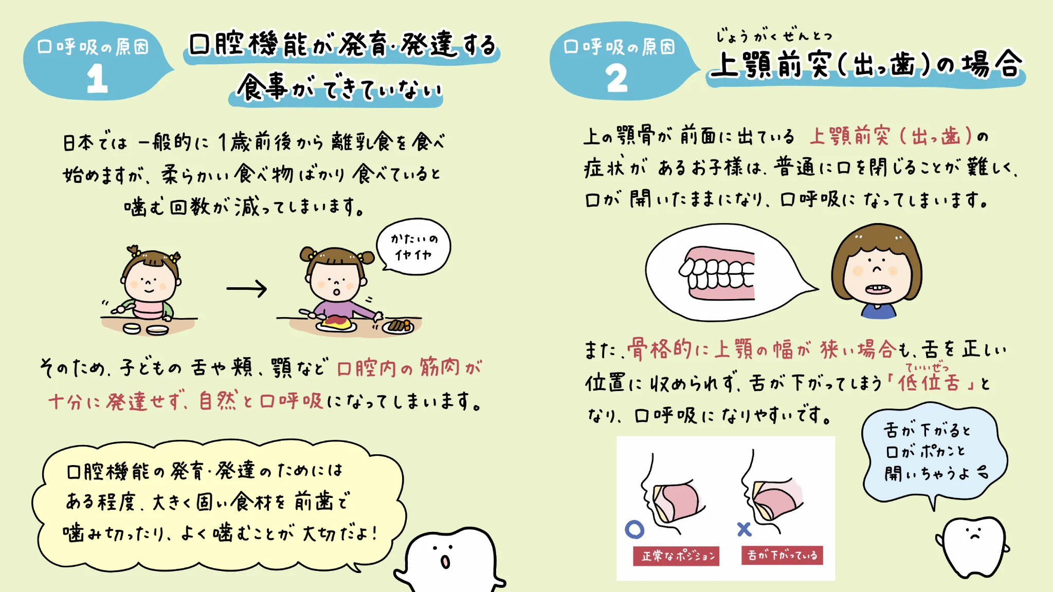 口呼吸 ABC Dental＠子どもの歯医者さん on X: 