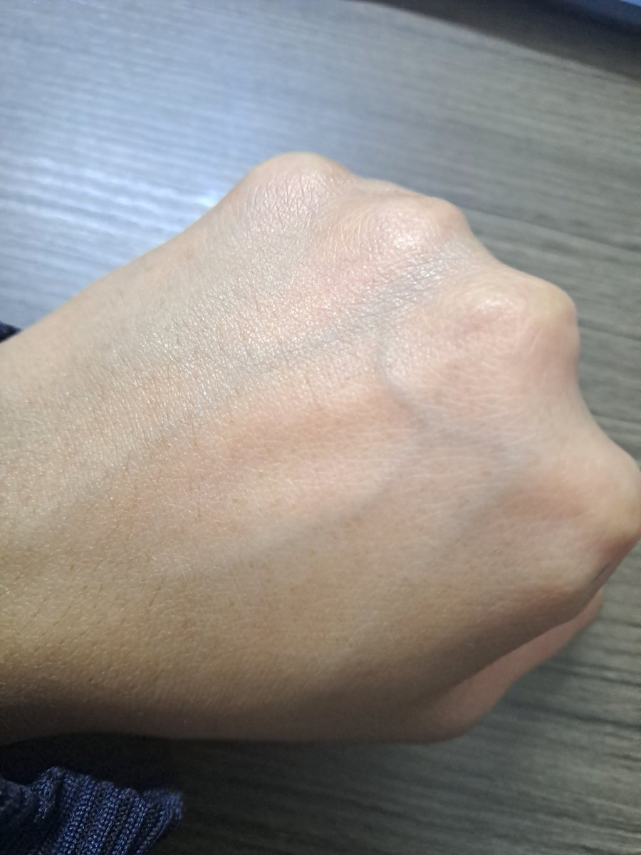 AtRandomThots's tweet image. Is my skin just too thin for my veins to be this visibly seen?