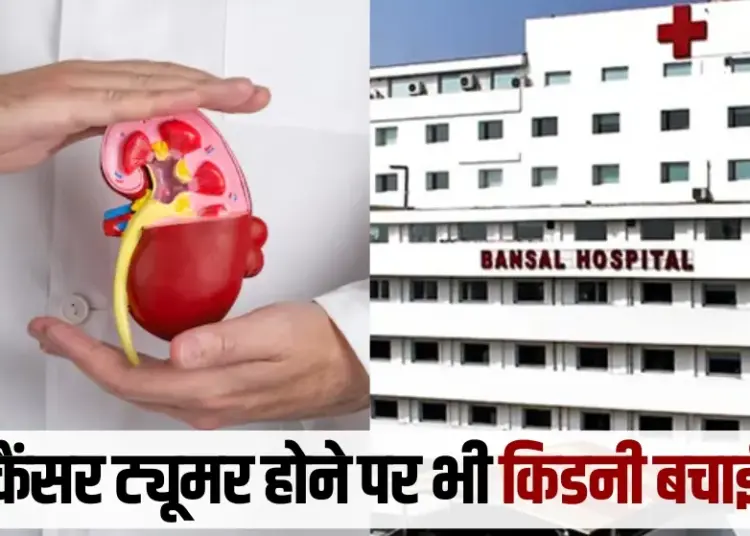 BansalNews_'s tweet image. Bhopal: बंसल हॉस्पिटल में किडनी बचाकर निकाला 5.5 सेंटीमीटर का कैंसर ट्यूमर, महानगरों से आधे खर्च में ठीक हुआ युवा मरीज

 पूरी खबर पढ़ें: bansalnews.com/bansal-hospita… 

#bhopalupdates #bhopalnews #Bhopal #MPNews #madyapradesh #MPUpdates #BansalHospital #hospital #KidneyTreatment