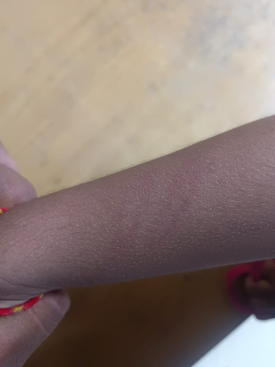 They did this to A 3-year old. A 3-YEAR OLD! 
Chhattisgarh nursery student hit, mouth sealed with tape for 'Radhe Radhe' greeting; principal held at Mother Teresa English Medium School in Bagdumar village.