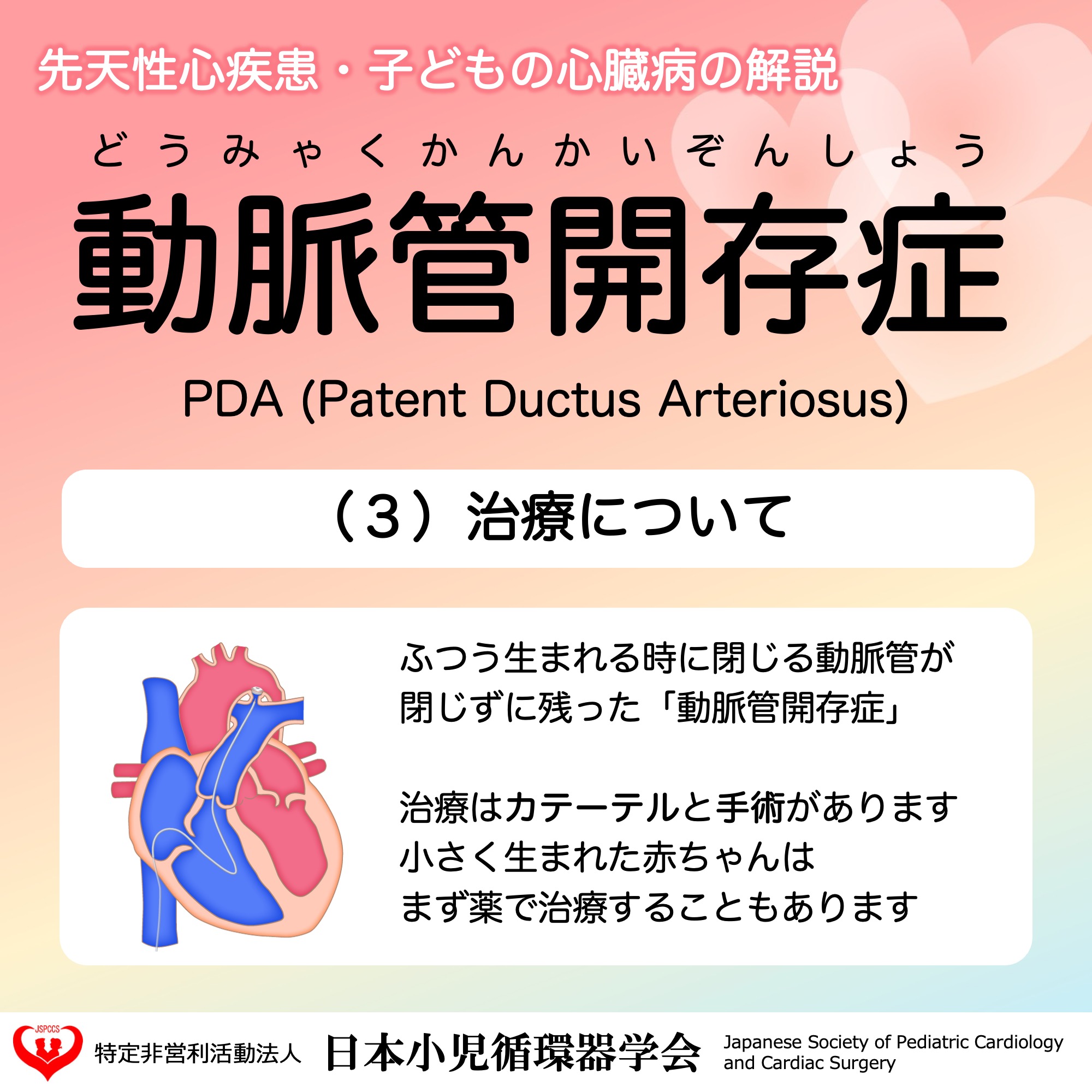 日本小児循環器学会【公式】 on X: 