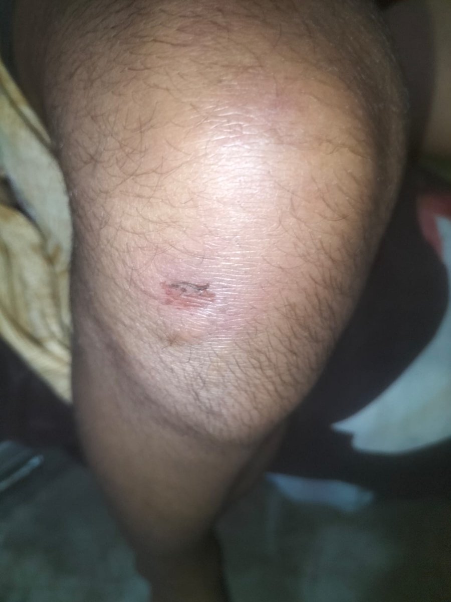 <a href="/Uppolice/">UP POLICE</a> का बड़ा कारनामा... थाने में दो नाबालिग युवती को बंद कर बेरहमी से आधी रात तक पीटा

#Lucknow : सुप्रसिद्ध बुद्धेश्वर महादेव मंदिर में युवती महिमा शर्मा व उनकी छोटी बहन रोजाना संध्या आरती में शामिल होने जाती थी, रोजाना की तरह दिनांक 28-07-2025 को भी संध्या आरती में शामिल