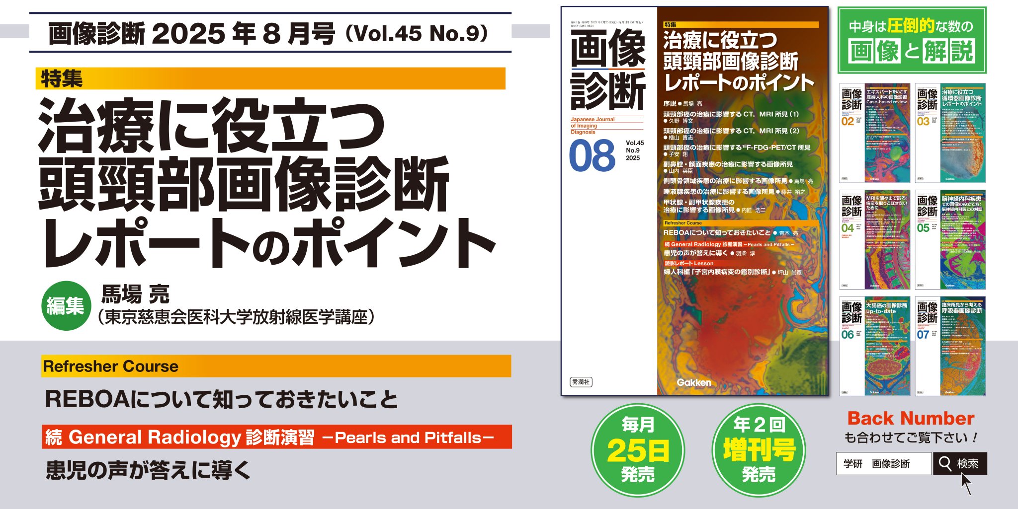 画像診断レポートこれだけは落とせない!主治医に伝えるべきポイント2022年10… 画像診断｜株式会社Gakkenメディカル事業部