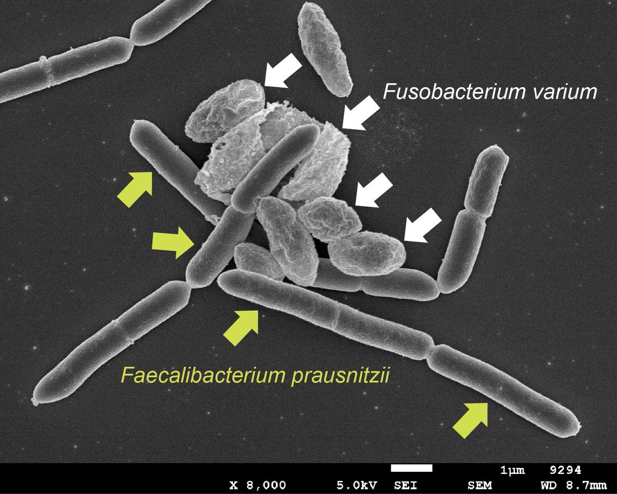 Helping me, inhibiting you: Analysis of interactions between #intestinal #microbiota: alphagalileo.org/en-gb/Item-Dis… 

<a href="/OsakaMetUniv_en/">Osaka Metropolitan University</a> #Lifesciences <a href="/alphagalileo/">AlphaGalileo</a>