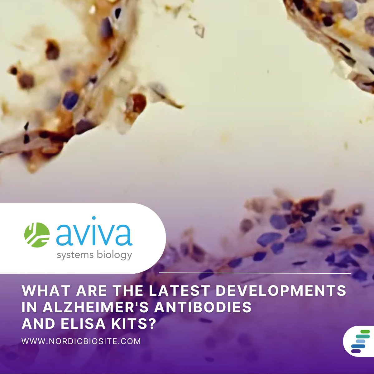 🧠 Working on Alzheimer’s research?
Check out our latest blog where we highlight Aviva Systems Biology and their range of antibodies and ELISA kits designed to support studies on key Alzheimer’s targets like Tau, APP, and Aβ peptides.
hubs.la/Q03xC2L-0