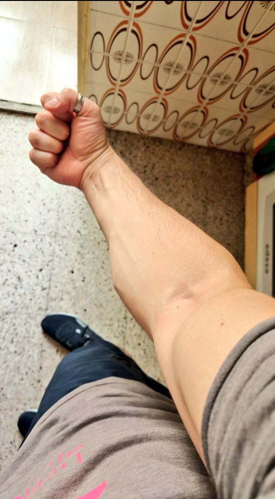 Veis este brazo? Pues tiene un 0.7 de kd 😎😭