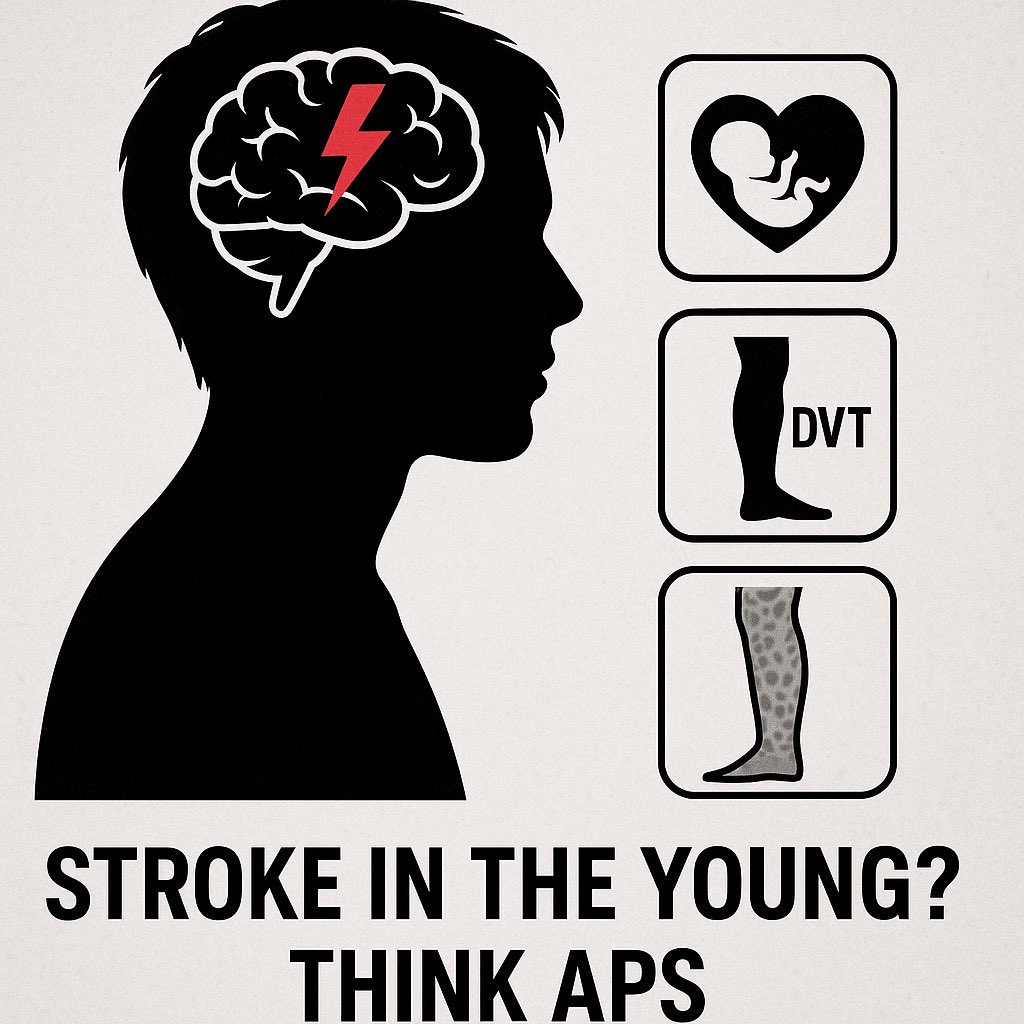 1️⃣ Stroke in the Young? Think APS.

Up to 20–30% of ischemic strokes in young adults have APS as an underlying cause.

🧠 Especially if:
• No classic CV risk factors
• History of miscarriages or DVT
• Livedo reticularis or thrombocytopenia

#Stroke #Antiphospholipid