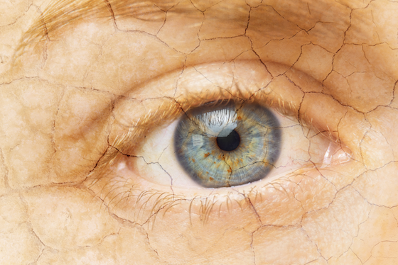 NatEyeInstitute's tweet photo. July is #DryEyeAwarenessMonth!
New treatments (like nasal sprays and eye drops) are helping people find relief from #DryEye.
Learn more from @AcademyEyeSmart:
https://t.co/Aprstuhb32
#EyeHealth #HealthyVision #OccularHealth #DryEyeRelief https://t.co/JwkAvTzDF7