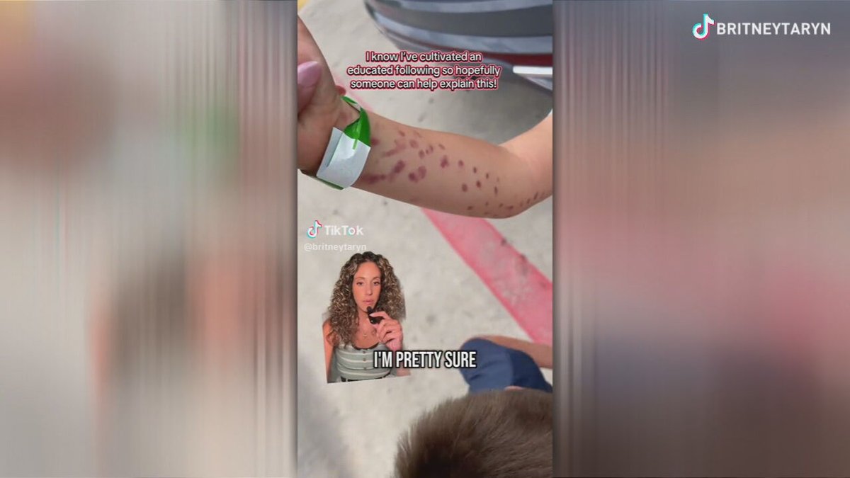 Viral TikTok video shows octopus attack a young boy at San Antonio Aquarium. bit.ly/4ldLOjz