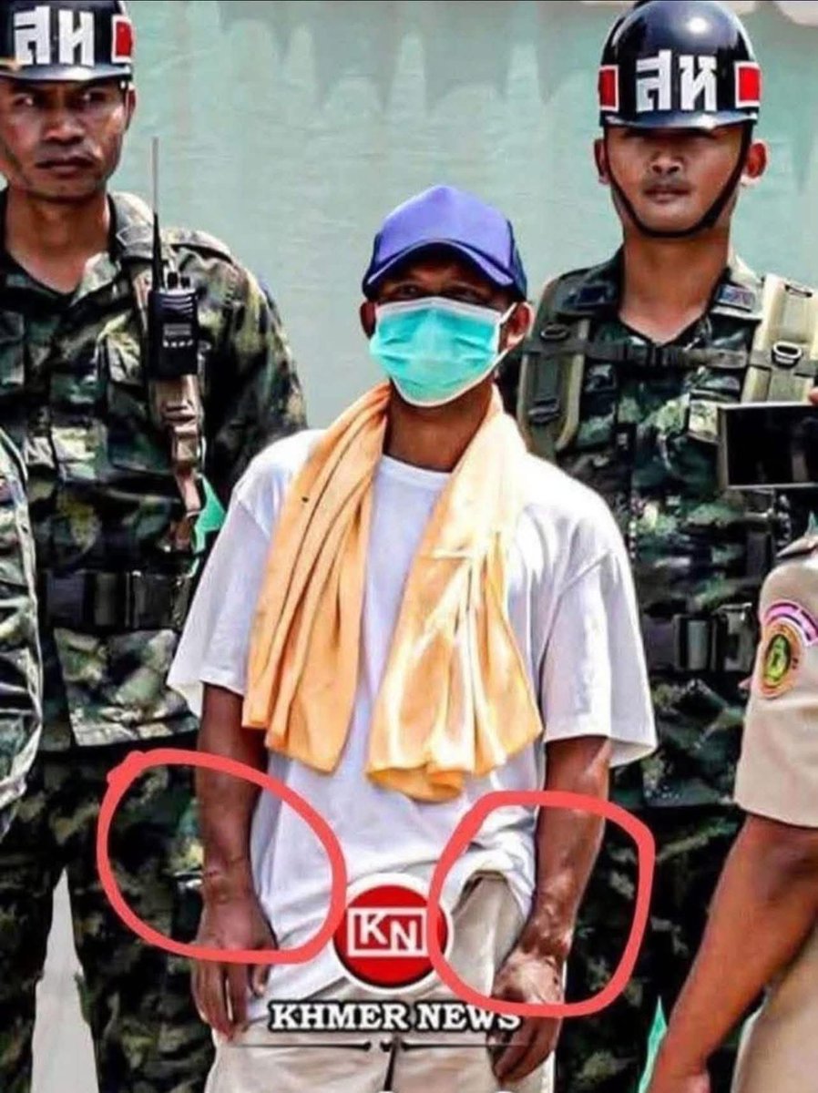 Veasna_btsarmy7's tweet photo. ទាហ៊ានខ្មែរ 2 រូប ត្រឡប់មកវិញ ក្នុងស្ថានភាពធ្វើទារុណកម្ម ស្មារតីមិននឹងនរ និង ពិកាភាពលើរទេះ

RELEASE CAPTURED CAMBODIAN SOLDIERS 
#JusticeForCambodia 
#FreeCambodianSoldiers https://t.co/PTRJoDn8cC