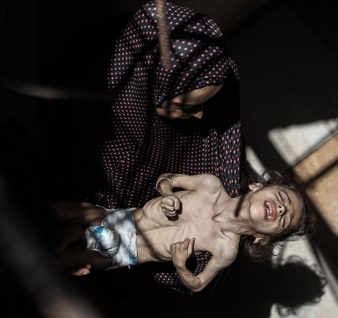 If you’re scrolling, PLEASE leave a dot.

STARVATION.