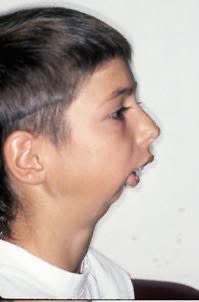 #Syndrome

What is the diagnosis?

#MEDHM #MedX <a href="/IhabFathiSulima/">Dr Ihab Suliman</a>