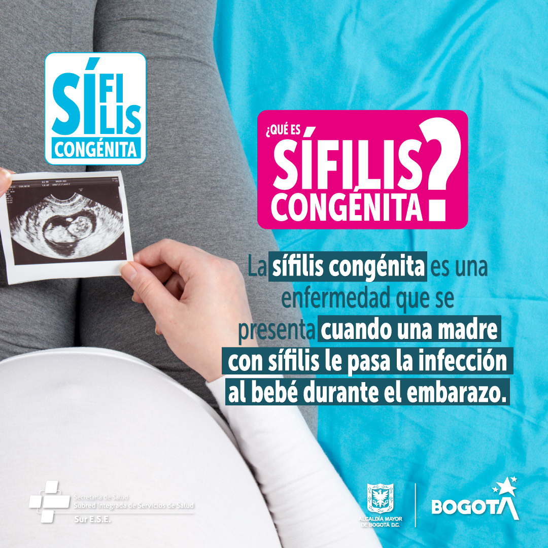 #OjoConLaSífilis 🦠 La gestación es uno de los momentos más importantes en la vida de una mujer🤰, realizando los controles prenatales demuestras responsabilidad y amor a tu hijo. 👶 La sífilis es una enfermedad que le puedes trasmitir en el embarazo o el parto y es prevenible.
