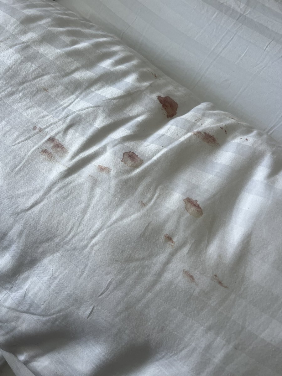 BeedotJay's tweet photo. I suffered a head injury and went to the medical deck while cruising on @RoyalCaribbean; the doctor on @wonderofthesea did practically nothing  to provide help. I lost consciousness and he didn’t evaluate me for concussion…@RoyalCaribPR https://t.co/hGB4LHJU01