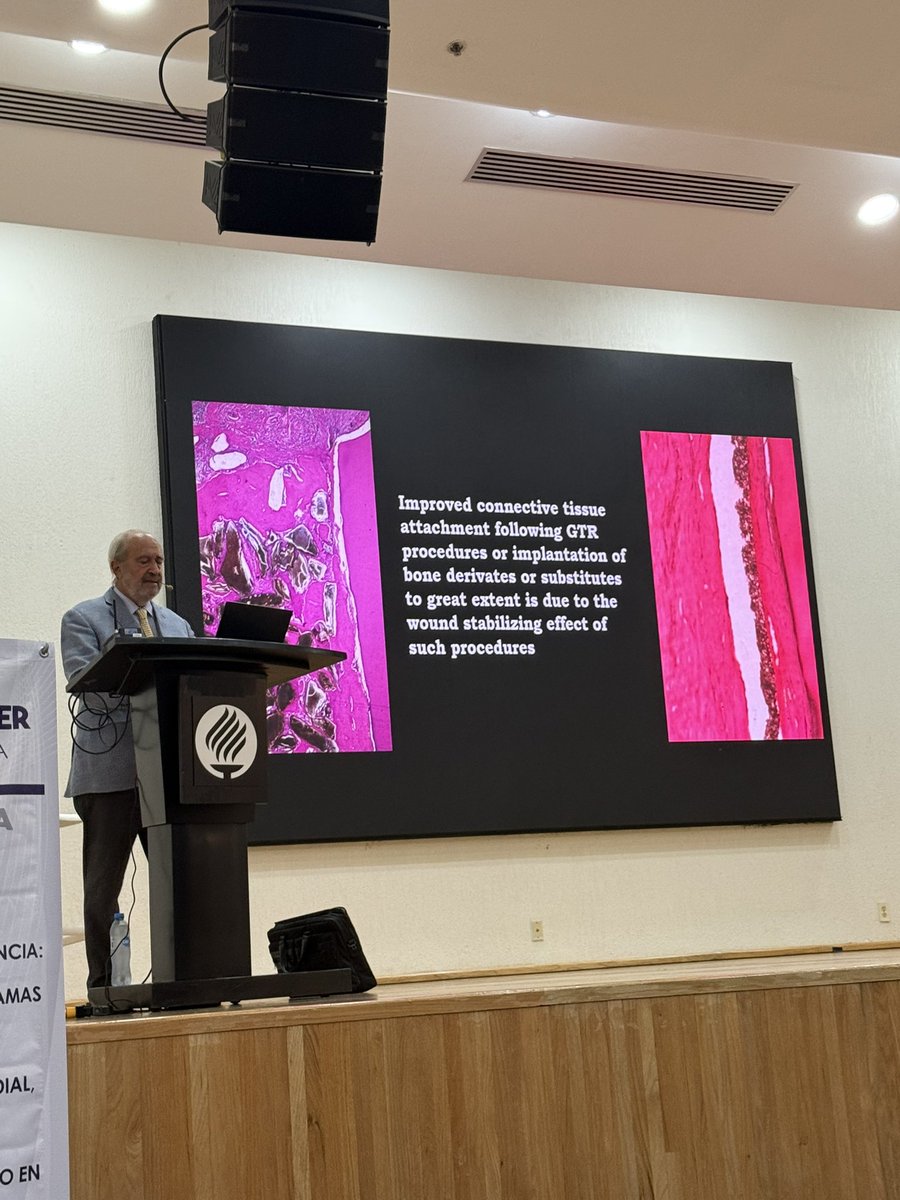 PerioMX's tweet image. De nuevo : la clave de la regeneración periodontal es la estabilidad del coágulo #massimodesanctis