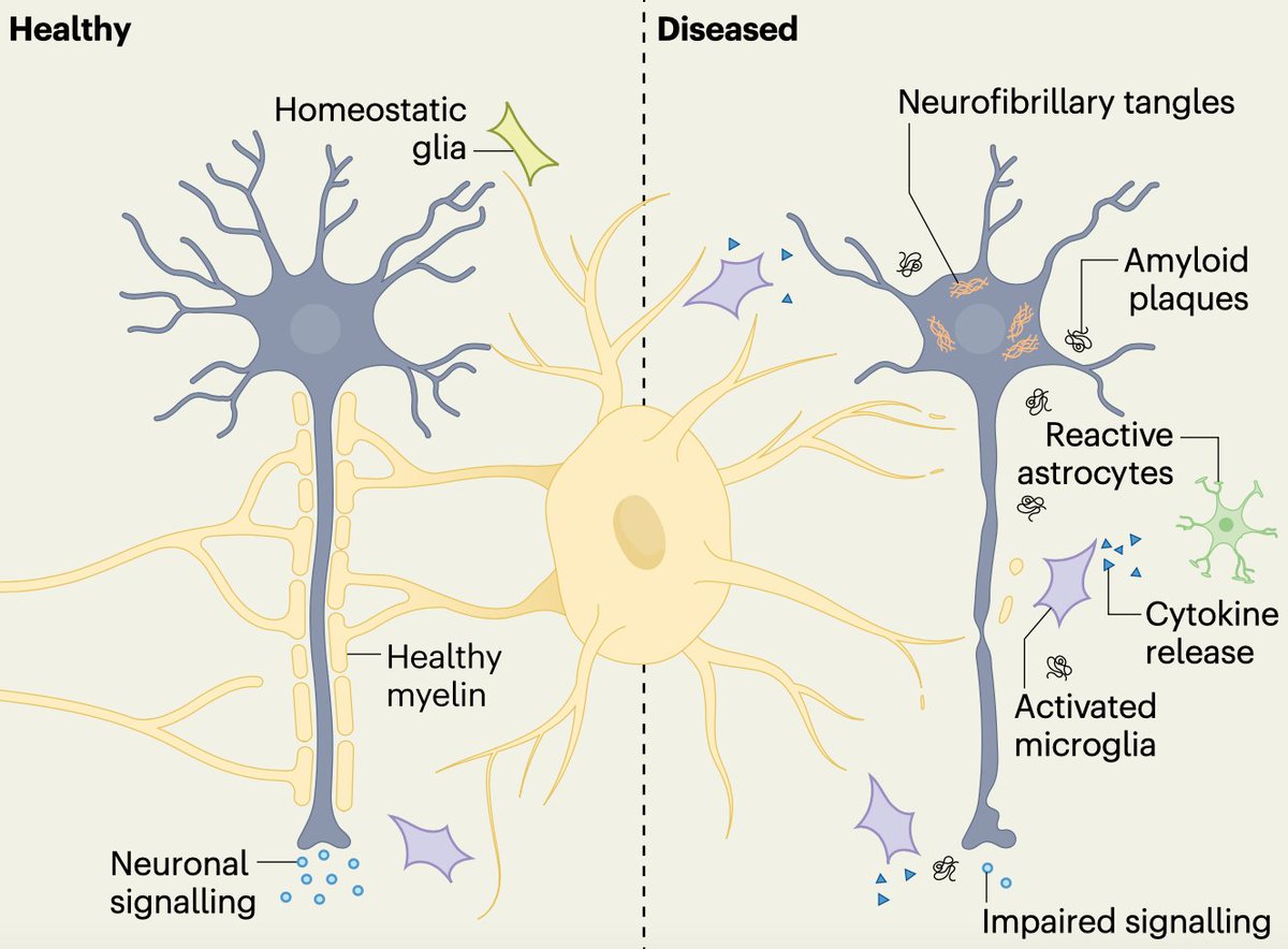 Friedman Brain Institute (@sinaibrain) on Twitter photo "Recent literature has explored contributions of oligodendrocytes & myelin dysfunction to #Alzheimers." Here, Anna Bright <a href="/leyla_aakay/">Leyla Akay</a> <a href="/JoelWBlanchard1/">Joel W. Blanchard</a> & Li-Huei Tsai "discuss evidence oligodendrocytes may directly contribute to AD pathology & progression"
nature.com/articles/s4155… "Recent literature has explored contributions of oligodendrocytes & myelin dysfunction to #Alzheimers." Here, Anna Bright <a href="/leyla_aakay/">Leyla Akay</a> <a href="/JoelWBlanchard1/">Joel W. Blanchard</a> & Li-Huei Tsai "discuss evidence oligodendrocytes may directly contribute to AD pathology & progression"
nature.com/articles/s4155…