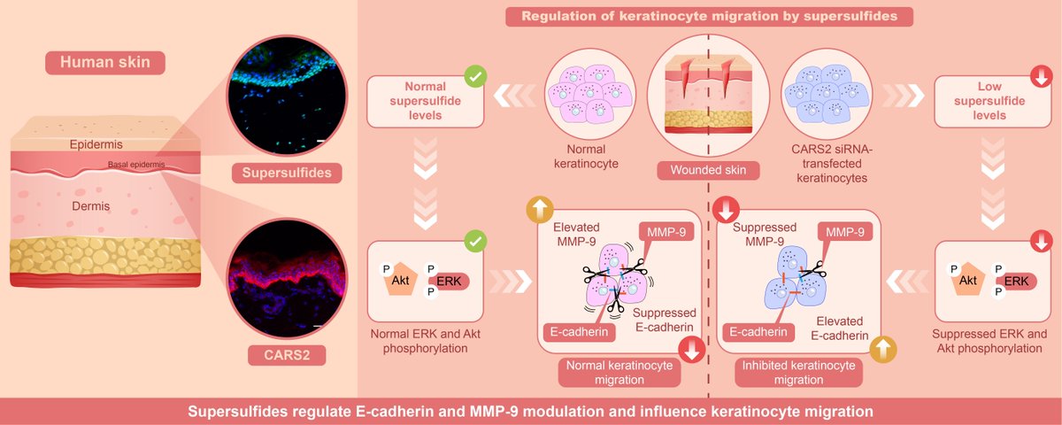 Researchers propose that supersulfide in the skin may represent a novel mechanism of re-epithelialization and may serve as a therapeutic target for skin wounds. 🎯 

🔗 bit.ly/44V1Dqy