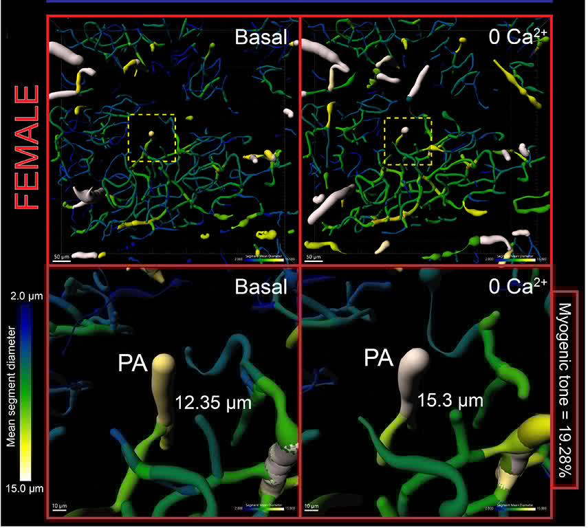 Circulation Research (@circres) on Twitter photo Jeffrey et al found that #estrogen opposes myogenic tone in female hippocampal #arterioles predominantly through increased #EC #SK channel activity & expression. Learn more at ahajrnls.org/45aotcA
@daniann3 <a href="/DabertrandFab/">Fabrice Dabertrand</a> <a href="/OsamaHarraz/">Osama Harraz</a> Jeffrey et al found that #estrogen opposes myogenic tone in female hippocampal #arterioles predominantly through increased #EC #SK channel activity & expression. Learn more at ahajrnls.org/45aotcA
@daniann3 <a href="/DabertrandFab/">Fabrice Dabertrand</a> <a href="/OsamaHarraz/">Osama Harraz</a>