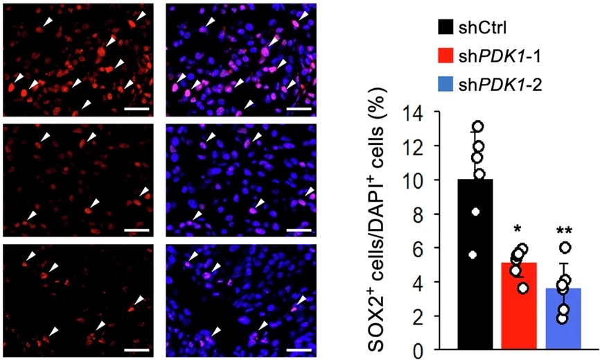 New in <a href="/cddpress/">CDD press</a>!💡

This study investigated the metabolic reliance of #osteosarcoma stem cells and related genes through in silico analyses of clinical osteosarcoma specimens and in vitro and in vivo genetic and pharmacological analyses.

go.nature.com/41l6saj