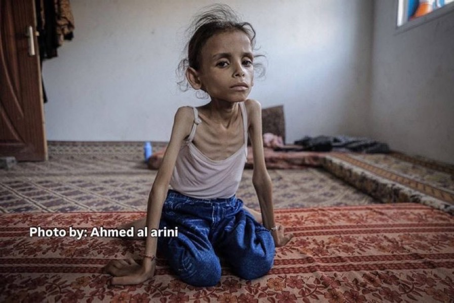 Imagine this was your child.