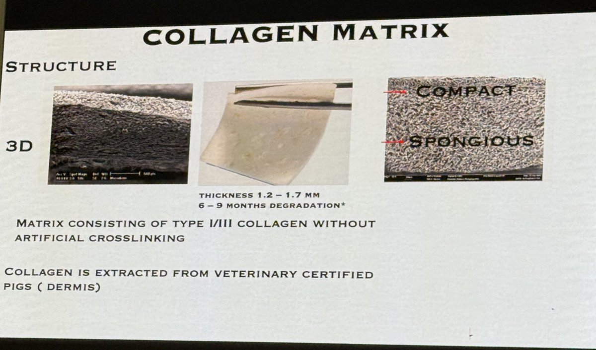 PerioMX's tweet image. Las matrices colagénicas son las más usadas con lo sustitutos de tejido blando #sofiaaroca
