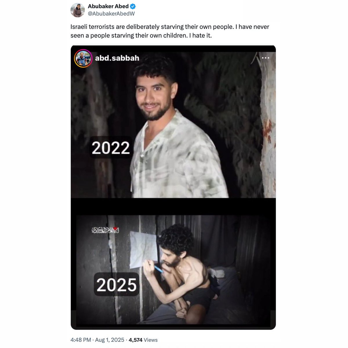 Abubaker Abed—a terrorist posing as a journalist—posts a photo of an Israeli hostage who was kidnapped, tortured, and starved by Hamas.

His comment: "Israeli terrorists are deliberately starving their own people. I have never seen a people starving their own children. I hate