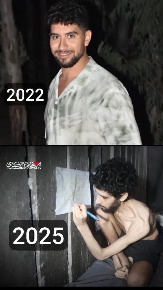 الآن
سيصدّق العالم "المتحضر" أن غزة في مجاعة
وستسارع الأنظمة المتواطئة لإدانة الجريمة
وسيعقد الوزراء المؤتمرات لإنقاذ الأسرى المجوّعين
وستنهال الاتهامات على المقاومة وإجرامها
وسيحدثك علماء السلطان عن معاملة الأسير في الإسلام
وسيبدأ الإعلام نشراته بصورة الأسير النحيل والبكاء على