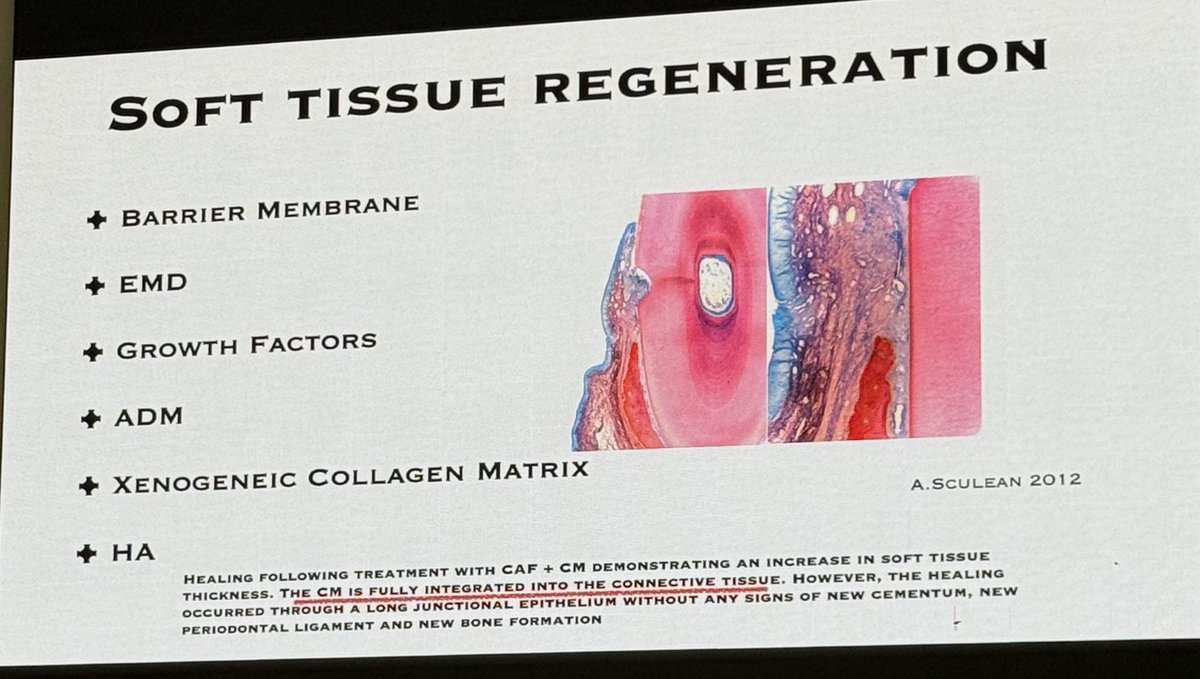 PerioMX's tweet image. Los materiales que han mostrado cierto éxito en la regeneración de tejido blando son :
