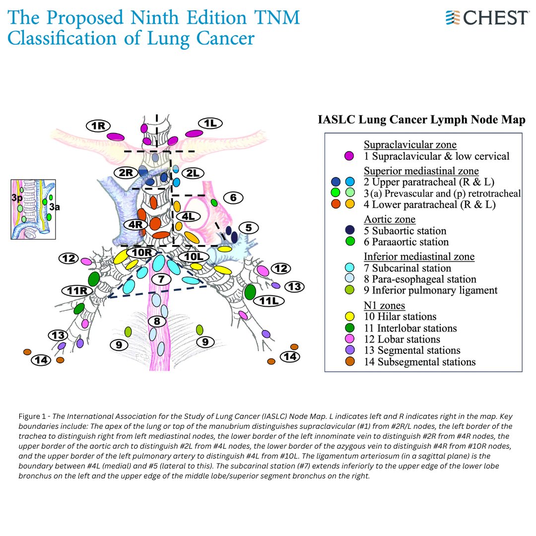 For World Lung Cancer Day, explore the research shaping lung cancer staging. The ninth edition TNM classification—effective since January 2025—is highlighted in the journal CHEST®: hubs.la/Q03zRGT00
#WorldLungCancerDay #MedEd #JournalCHEST
