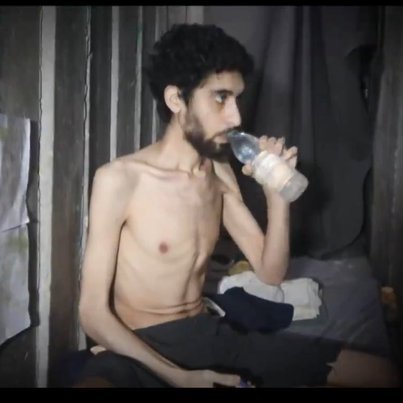 Hunger als Waffe wird in Gaza tatsächlich eingesetzt. Gegen die Geiseln. 80 Jahre nach 1945 wieder Bilder fast verhungerter Juden sehen zu müssen, ist eine Schande. 
Und ja: auch pal. Bevölkerung leidet! All das endet mit der Herrschaft der Hamas und der Freilassung der Geiseln.