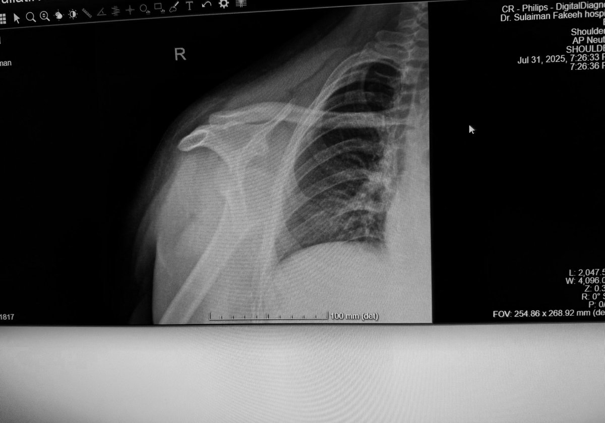 Wed_244's tweet photo. Just completed my summer training at Fakeeh Hospital, grateful for every moment and for everyone who was part of it !🤍 https://t.co/bWGp7T1P8c