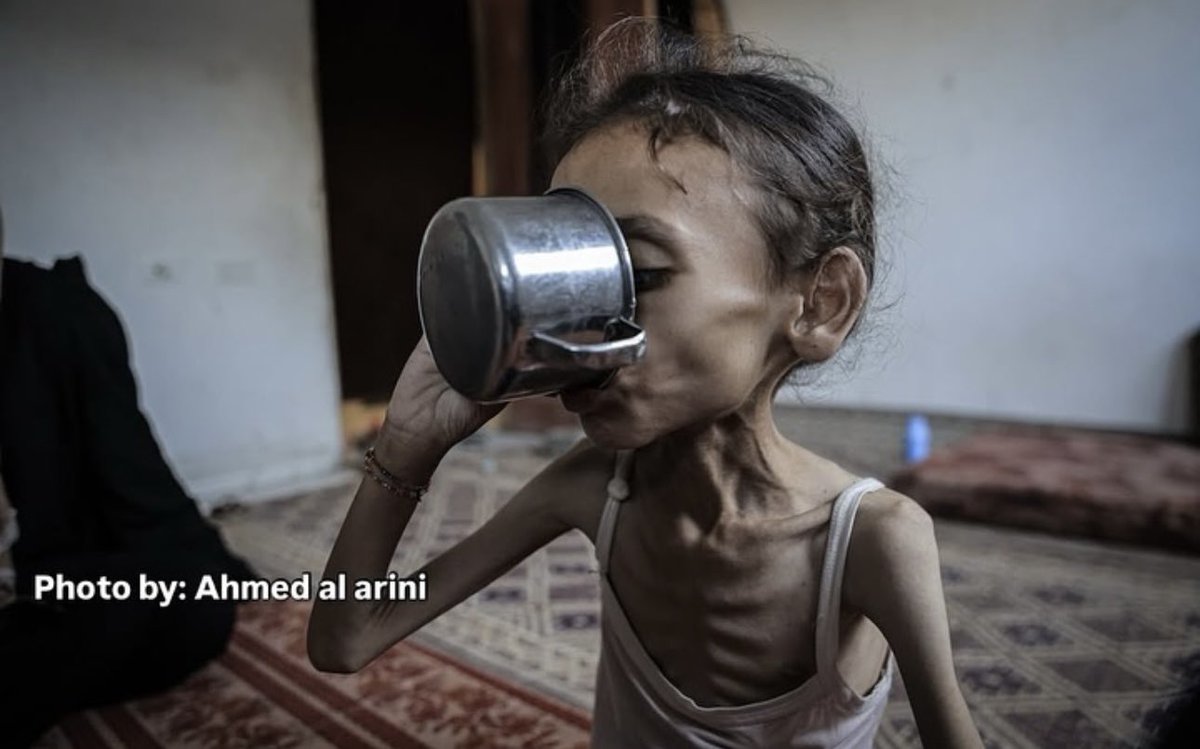 yousef_ki1's tweet image. If you’re scrolling, PLEASE leave a dot.

STARVATION.