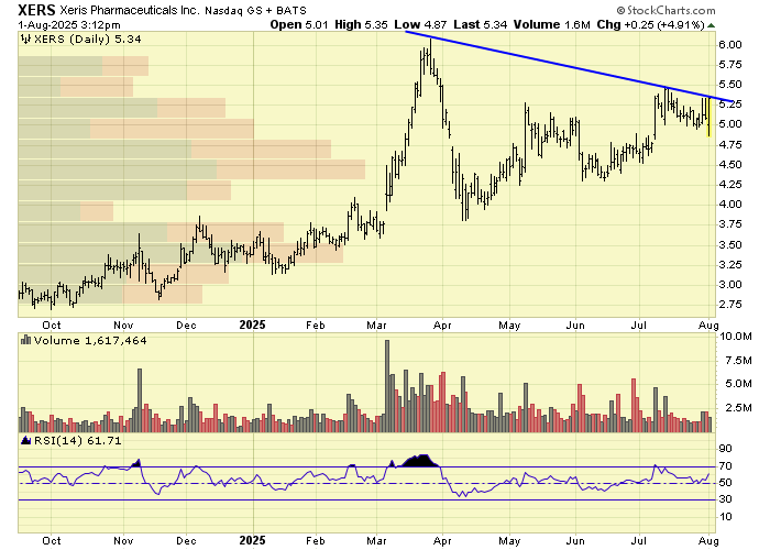 kkernttb's tweet photo. $XERS
breakout watch https://t.co/LsAXVNStCx