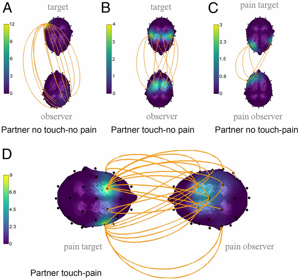 On sait désormais mieux pourquoi tenir la main d'un être cher, réduit la douleur. 

L'étude publiée dans PNAS explore comment le contact social, notamment le fait de se tenir la main pendant une douleur, réduit la perception de la douleur grâce à un mécanisme de couplage cérébral
